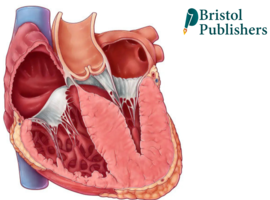 Dilated Cardiomyopathy Case Reports
